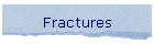 Fractures